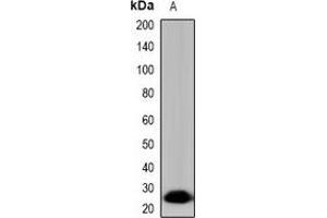 Western blot analysis of Tryptase delta expression in HepG2 (A) whole cell lysates. (TPSD1 抗体)