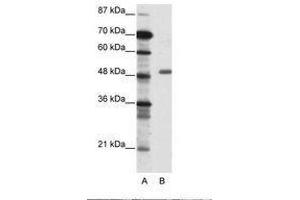 Image no. 1 for anti-Transcriptional Adaptor 3 (TADA3) (AA 156-205) antibody (ABIN6736087) (TADA3L 抗体  (AA 156-205))