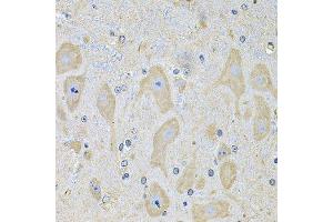 Immunohistochemistry of paraffin-embedded mouse brain using EPHA2 Antibody. (EPH Receptor A2 抗体  (AA 847-976))