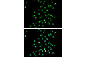 Immunofluorescence analysis of A549 cells using CXXC1 antibody (ABIN5973429). (CXXC1 抗体)