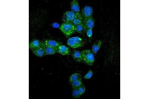 IF analysis of HYI using anti-HYI antibody (ABIN7601796). (HYI 抗体  (AA 46-277))