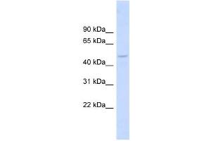 DBNL antibody used at 1 ug/ml to detect target protein. (DBNL 抗体  (Middle Region))