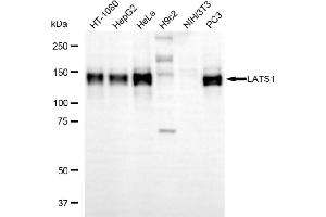 Western blotting analysis using LATS1 antibody (ABIN7799240).