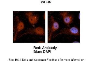 Sample Type :  Human brain stem cells (NT2)   Primary Antibody Dilution :   1:500  Secondary Antibody :  Goat anti-rabbit Alexa Fluor 594  Secondary Antibody Dilution :   1:1000  Color/Signal Descriptions :  Red: WDR5 Blue: DAPI  Gene Name :  WDR5  Submitted by :  Dr. (WDR5 抗体  (C-Term))