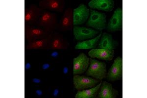 Phospho-SIRT6 (Thr294) Antibody staining A549 cells(4h of LPS treatment) by IF/ICC. (SIRT6 抗体  (pThr294))