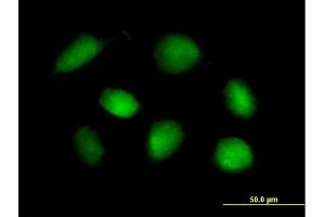 Immunofluorescence of purified MaxPab rabbit antibody to STK11 on HeLa cell. (LKB1 抗体  (AA 1-433))