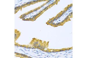Immunohistochemistry of paraffin-embedded human prostate using BTD antibody at dilution of 1:100 (40x lens). (BTD 抗体)