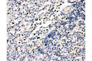 Anti-FLI1 antibody, IHC(P) IHC(P): Human Tonsil Tissue (FLI1 抗体  (N-Term))