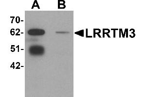 Western Blotting (WB) image for anti-Leucine Rich Repeat Transmembrane Neuronal 3 (LRRTM3) (C-Term) antibody (ABIN1030498) (LRRTM3 抗体  (C-Term))