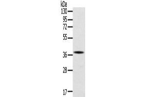 Western Blotting (WB) image for anti-Secreted Protein, Acidic, Cysteine-Rich (Osteonectin) (SPARC) antibody (ABIN2422187) (SPARC 抗体)