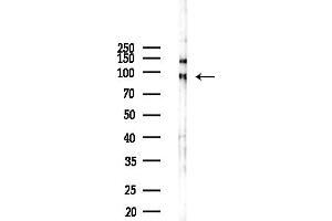 anti-Sec23 Homolog B (SEC23B) (Internal Region) antibody