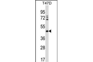 DEGS1 Antibody (N-term) (ABIN657334 and ABIN2846402) western blot analysis in T47D cell line lysates (35 μg/lane). (DEGS1 抗体  (N-Term))