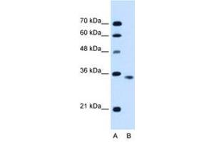 Image no. 1 for anti-Activin A Receptor, Type IIB (ACVR2B) (C-Term) antibody (ABIN6736679) (ACVR2B 抗体  (C-Term))