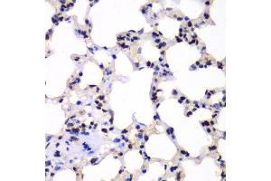 Immunohistochemistry of paraffin-embedded rat lung using UBE2B antibody at dilution of 1:100 (x40 lens). (UBE2B 抗体)