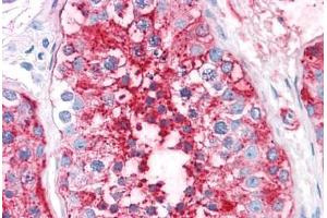 Human Testis: Formalin-Fixed, Paraffin-Embedded (FFPE) (ADAM20 抗体  (Internal Region))