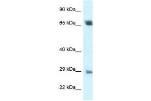 Western Blot showing SPC25 antibody used at a concentration of 1 ug/ml against 721_B Cell Lysate (SPC25 抗体  (Middle Region))