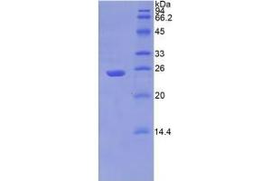 SDS-PAGE analysis of Human PSA Protein. (NPEPPS 蛋白)