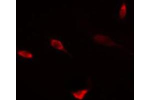 ABIN6274456 staining HT29 cells by IF/ICC. (DPF2 抗体  (Internal Region))