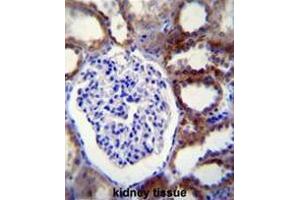 CASP3 Antibody (C-term) immunohistochemistry analysis in formalin fixed and paraffin embedded human kidney tissue followed by peroxidase conjugation of the secondary antibody and DAB staining. (Caspase 3 抗体  (C-Term))