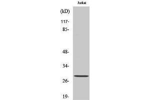 Western Blotting (WB) image for anti-Glutathione S-Transferase theta 1/4 (GSTT1/4) (N-Term) antibody (ABIN3184959) (GSTT1/4 抗体  (N-Term))