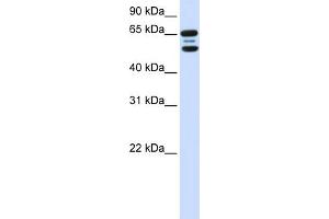 WB Suggested Anti-FBXO21 Antibody Titration:  0. (FBXO21 抗体  (N-Term))