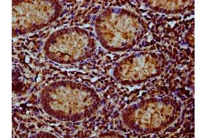 IHC image of ABIN7160882 diluted at 1:100 and staining in paraffin-embedded human appendix tissue performed on a Leica BondTM system. (NDUFAF3 抗体  (AA 91-184))