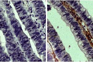 Immunohistochemistry (IHC) image for anti-Collagen, Type III (COL3) antibody (Biotin) (ABIN135051)