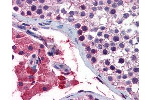 anti-Guanine Nucleotide Binding Protein (G Protein), Q Polypeptide (GNAQ) (AA 71-120) antibody