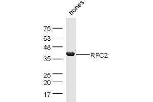 Mouse bone lysates probed with Rabbit Anti-RFC2 Polyclonal Antibody, Unconjugated  at 1:500 for 90 min at 37˚C. (RFC2 抗体  (AA 281-354))