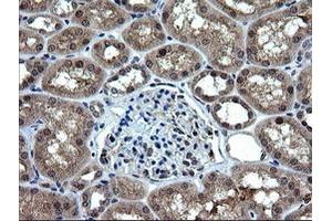 Image no. 3 for anti-RAB37, Member RAS Oncogene Family (RAB37) antibody (ABIN1500561)