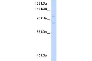 WB Suggested Anti-MCM8 Antibody Titration:  0. (MCM8 抗体  (C-Term))
