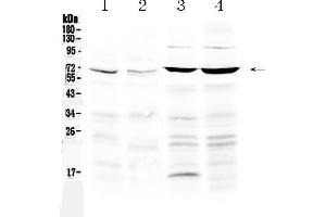 Western blot analysis of PPAR gamma using anti-PPAR gamma antibody .