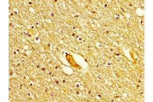 IHC image of ABIN7150227 diluted at 1:300 and staining in paraffin-embedded human brain tissue performed on a Leica BondTM system. (POLD1 抗体  (Catalytic Subunit))