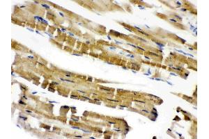 Cofilin 2 was detected in paraffin-embedded sections of mouse cardiac muscle tissues using rabbit anti- Cofilin 2 Antigen Affinity purified polyclonal antibody (Catalog # ) at 1 µg/mL. (Cofilin 2 抗体  (C-Term))