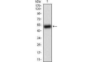 Western blot analysis using BACE1 mAb against human BACE1 (AA: 112-324) recombinant protein. (BACE1 抗体  (AA 112-324))