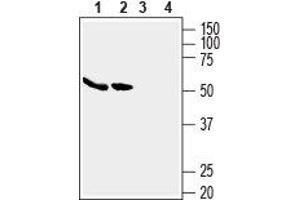 Western blot analysis of human MCF-7 breast adenocarcinoma cell lysates (lanes 1 and 3) and human Caco-2 colon adenocarcinoma cell lysates (lanes 2 and 4): - 1,2. (SLC2A5 抗体  (C-Term, Intracellular))