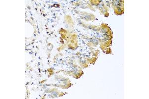 Immunohistochemistry of paraffin-embedded mouse lung using VTN antibody at dilution of 1:100 (40x lens). (Vitronectin 抗体)