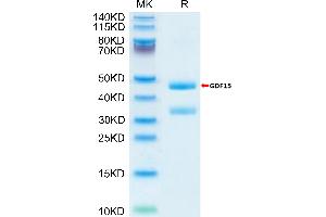 Biotinylated Moues GDF15 on Tris-Bis PAGE under reduced condition. (GDF15 Protein (AA 189-303) (Fc Tag,Biotin))