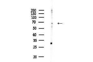 anti-Tyrosinase (TYR) antibody