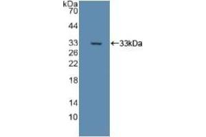 Detection of Recombinant DLD, Rat using Polyclonal Antibody to Dihydrolipoyl Dehydrogenase (DLD) (DLD 抗体)