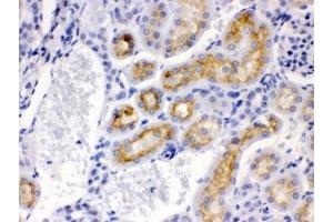 IHC testing of FFPE mouse kidney with CYP24A1 antibody. (CYP24A1 抗体  (AA 153-514))