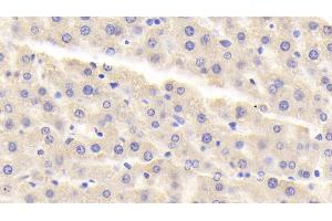 Detection of MAOA in Rat Liver Tissue using Polyclonal Antibody to Monoamine Oxidase A (MAOA) (Monoamine Oxidase A 抗体  (AA 2-497))