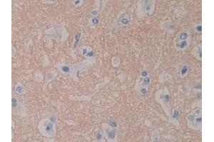 DAB staining on IHC-P; Samples: Human Cerebrum Tissue (RPN1 抗体  (AA 24-179))