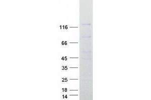 Western Blotting (WB) image for Nucleoporin 133kDa (NUP133) protein (Myc-DYKDDDDK Tag) (ABIN2727807)