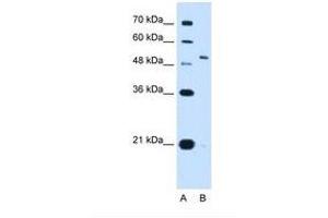 Image no. 1 for anti-Potassium Voltage-Gated Channel, Shaw-Related Subfamily, Member 1 (KCNC1) (AA 21-70) antibody (ABIN321117) (KCNC1 抗体  (AA 21-70))