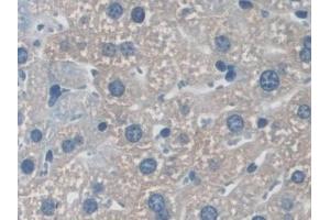 Detection of NXN in Mouse Liver Tissue using Polyclonal Antibody to Nucleoredoxin (NXN)