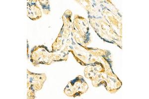 Immunohistochemistry of paraffin embedded human placenta using GRASP (ABIN7074140) at dilution of 1:400 (400x lens) (Tamalin/GRASP 抗体)
