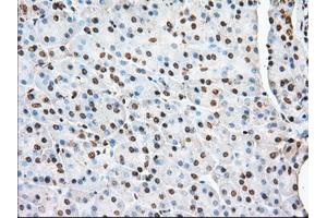 Immunohistochemical staining of paraffin-embedded Human liver tissue using anti-ACAT2 mouse monoclonal antibody. (ACAT2 抗体)