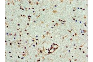 Immunohistochemistry of paraffin-embedded human brain tissue using ABIN7166631 at dilution of 1:100 (PNP 抗体  (AA 1-289))
