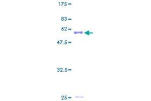 AIMP1 Protein (AA 1-312) (GST tag)